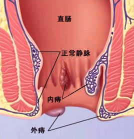 Patient home-Shenzhen Xingyin Pharmaceutical Co., LTD