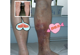 Disease prevention and treatment-Shenzhen Xingyin Pharmaceutical Co., LTD