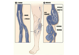 Disease prevention and treatment-Shenzhen Xingyin Pharmaceutical Co., LTD