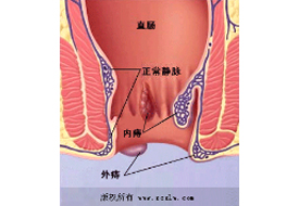 疾病防治-3044am永利集团